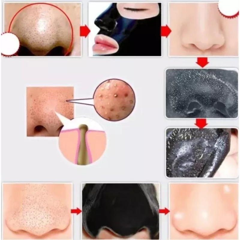 Mascara Limpiador Facial Antiacne Puntos Negros X10