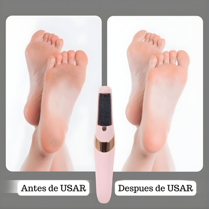 Removedor de Callos USB Inalámbrico